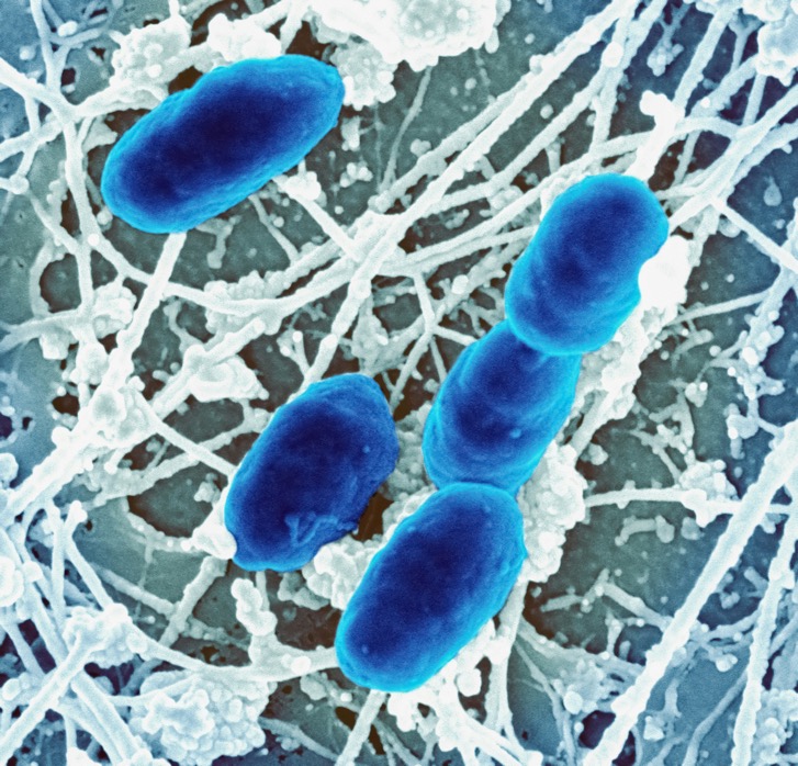 bakterien. SIBO.Leaky gut