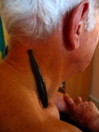 Blutegeltherapie Lörrach