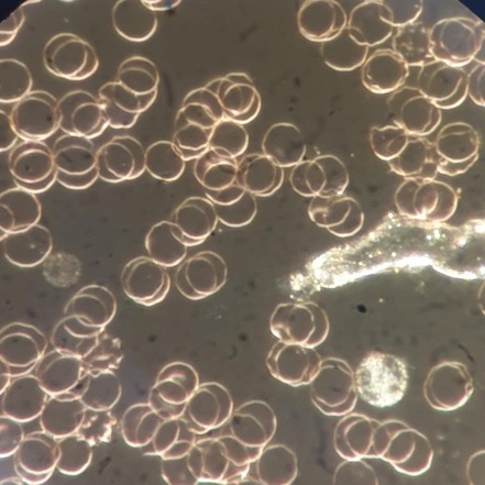 Dunkelfeldanalyse Lörrach